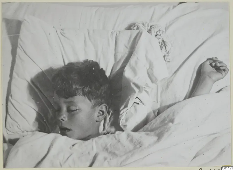 A young boy asleep on a white pillow, one arm raised beside his head, in Nicosia.