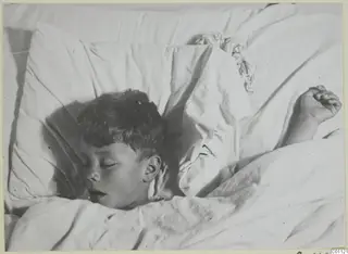 A young boy asleep on a white pillow, one arm raised beside his head, in Nicosia.