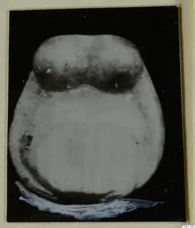 Bone find from Amathus, a pale rounded object