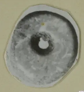 Flat round object with a central hole, from Amathus tombs 2-26