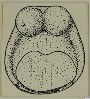 Stippled ink drawing of a solid object with two rounded lobes at the top and a larger notched lobe below.